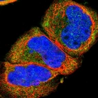 Immunofluorescent staining of human cell line A-431 shows localization to cytosol.