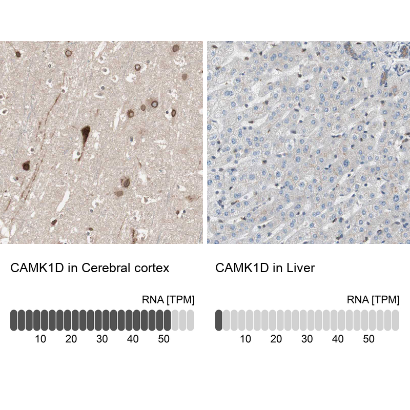 Anti-CAMK1D Antibody