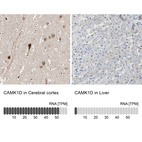 Anti-CAMK1D Antibody