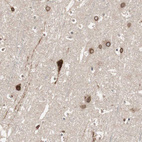 Immunohistochemical staining of human cerebral cortex shows moderate to strong cytoplasmic positivity in neurons.