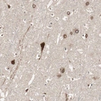 Immunohistochemical staining of human cerebral cortex shows moderate to strong cytoplasmic positivity in neurons.