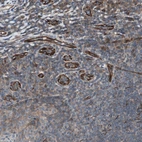 Immunohistochemical staining of human tonsil shows moderate to strong cytoplasmic positivity in endothelial cells.