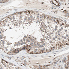 Immunohistochemical staining of human testis shows moderate to strong cytoplasmic positivity in cells in seminiferous ducts.