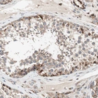 Immunohistochemical staining of human testis shows moderate to strong cytoplasmic positivity in cells in seminiferous ducts.