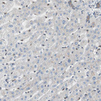 Immunohistochemical staining of human liver shows no positivity in hepatocytes as expected.