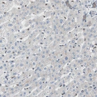 Immunohistochemical staining of human liver shows no positivity in hepatocytes as expected.