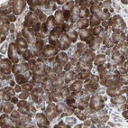 Anti-PGBD1 Antibody