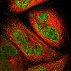 Immunofluorescent staining of human cell line A-431 shows localization to nucleoplasm & cytosol.
