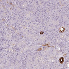 Immunohistochemical staining of human pancreas shows strong membranous positivity in interlobular ducts.