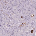 Immunohistochemical staining of human pancreas shows strong membranous positivity in interlobular ducts.