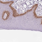 Immunohistochemical staining of human skin shows strong membranous positivity in squamous epithelial cells.