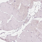 Immunohistochemical staining of human skeletal muscle shows no positivity in myocytes as expected.