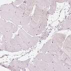 Immunohistochemical staining of human skeletal muscle shows no positivity in myocytes as expected.