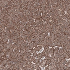 Immunohistochemical staining of human liver shows moderate membranous-cytoplasmic positivity in hepatocytes.