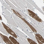 Immunohistochemical staining of human skeletal muscle shows strong cytoplasmic positivity in subset of cells in myocytes.