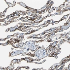 Immunohistochemical staining of human lung shows moderate membranous positivity in pneumocytes.