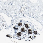Immunohistochemical staining of human breast shows strong membranous positivity in glandular cells.