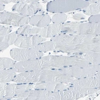 Immunohistochemical staining of human skeletal muscle shows no positivity in myocytes as expected.