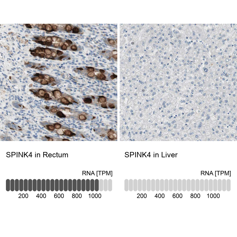 Anti-SPINK4 Antibody