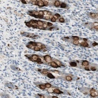 Immunohistochemical staining of human rectum shows high expression.