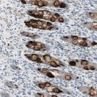 Immunohistochemical staining of human rectum shows high expression.