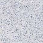 Immunohistochemical staining of human liver shows low expression as expected.