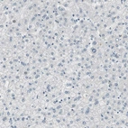 Immunohistochemical staining of human liver shows low expression as expected.