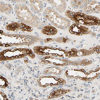 Immunohistochemical staining of human Kidney shows strong cytoplasmic positivity in cells in distal tubules.