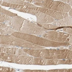 Immunohistochemical staining of human Skeletal muscle shows moderate cytoplasmic positivity in myocytes.