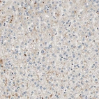 Immunohistochemical staining of human Liver shows very weak cytoplasmic positivity in hepatocytes.