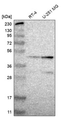 Western blot analysis in human cell line RT-4 and human cell line U-251 MG.