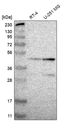 Western blot analysis in human cell line RT-4 and human cell line U-251 MG.