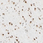 Anti-ZSCAN16 Antibody