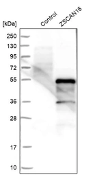 Western blot analysis in control (vector only transfected HEK293T lysate) and ZSCAN16 over-expression lysate (Co-expressed with a C-terminal myc-DDK tag (~3.1 kDa) in mammalian HEK293T cells, LY410777).