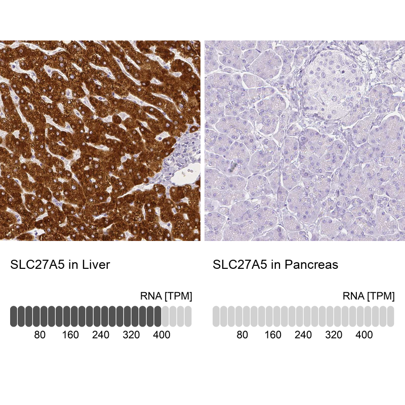 Anti-SLC27A5 Antibody