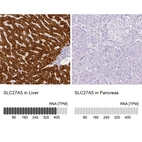Anti-SLC27A5 Antibody