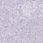 Immunohistochemical staining of human pancreas shows low expression as expected.