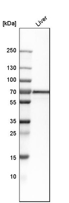 Anti-SLC27A5 Antibody