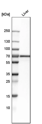 Western blot analysis in human liver tissue.
