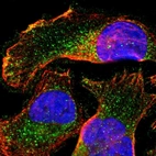 Immunofluorescent staining of human cell line U-2 OS shows localization to vesicles.