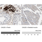 Anti-CALB2 Antibody