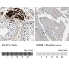 Anti-CALB2 Antibody