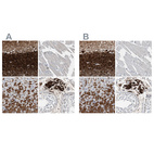 Immunohistochemical staining of human cerebellum, skeletal muscle, stomach and testis using Anti-CALB2 antibody HPA007305 (A) shows similar protein distribution across tissues to independent antibody HPA007306 (B).