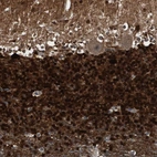 Immunohistochemical staining of human cerebellum shows strong cytoplasmic and nuclear positivity in cells in granular layer.