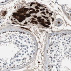 Immunohistochemical staining of human testis shows strong cytoplasmic and nuclear positivity in Leydig cells.
