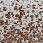 Anti-CALB2 Antibody