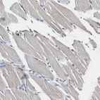 Immunohistochemical staining of human skeletal muscle shows no positivity in myocytes as expected.