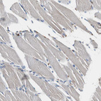 Anti-CALB2 Antibody