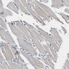 Immunohistochemical staining of human skeletal muscle shows no positivity in myocytes as expected.