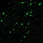 Immunofluorescence staining of mouse substantia nigra shows neuronal cell bodies and processes in pars compacta.